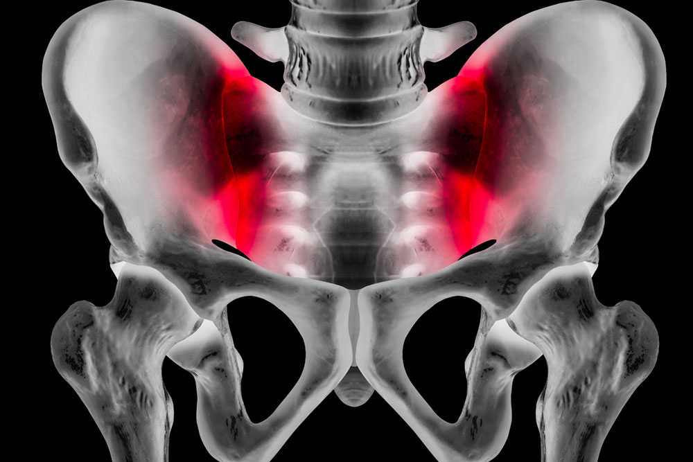 Sacro-Iliac